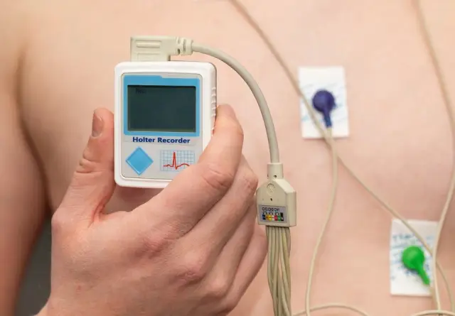 Holter ecg fes